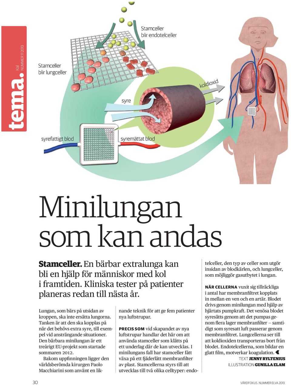 Den bärbara minilungan är ett treårigt EU-projekt som startade sommaren 2012.