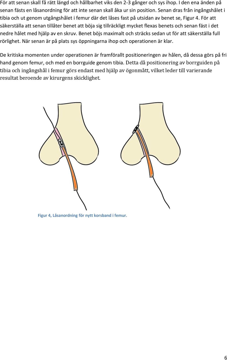 För att säkerställa att senan tillåter benet att böja sig tillräckligt mycket flexas benets och senan fäst i det nedre hålet med hjälp av en skruv.