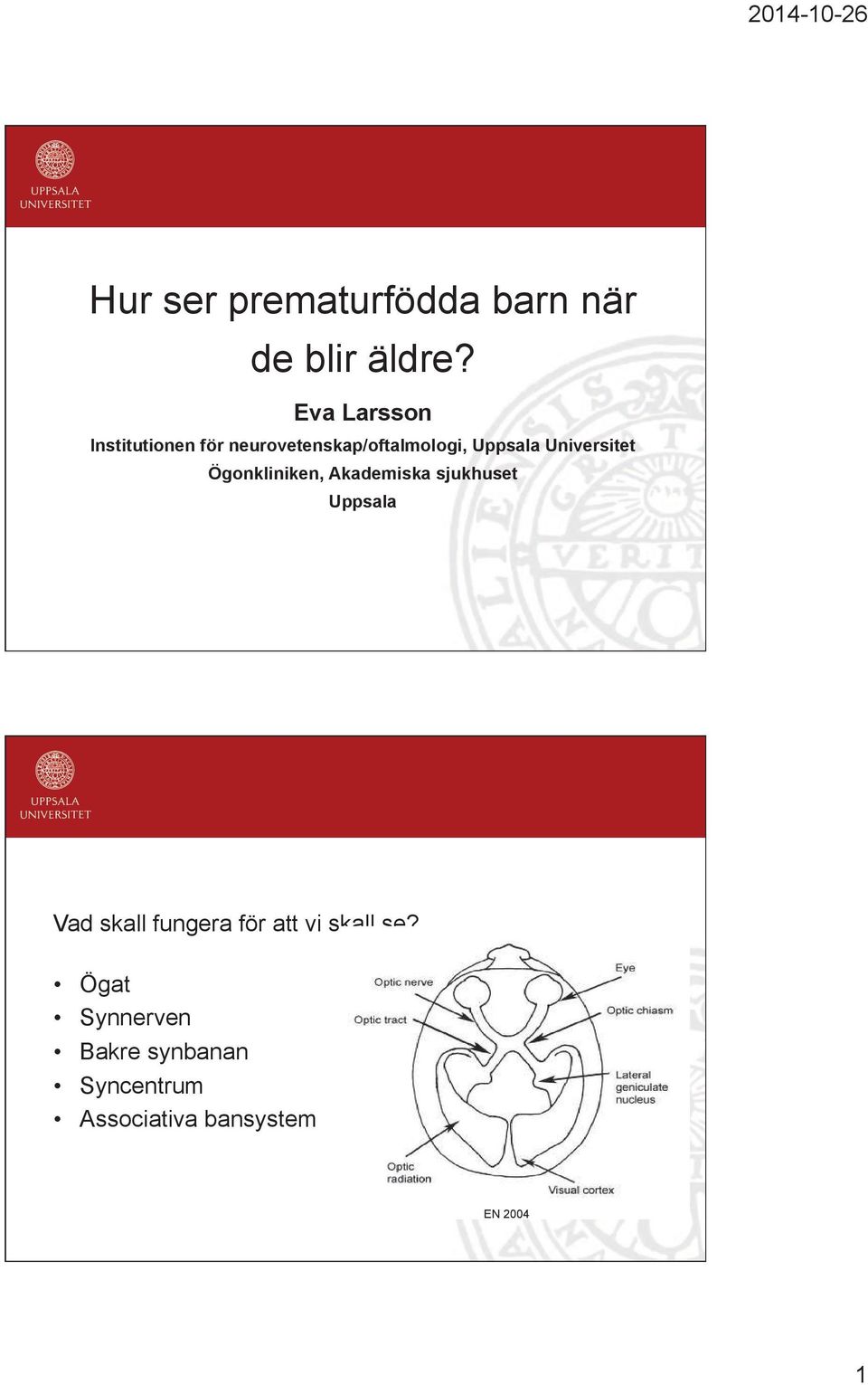 Universitet Ögonkliniken, Akademiska sjukhuset Uppsala Vad skall