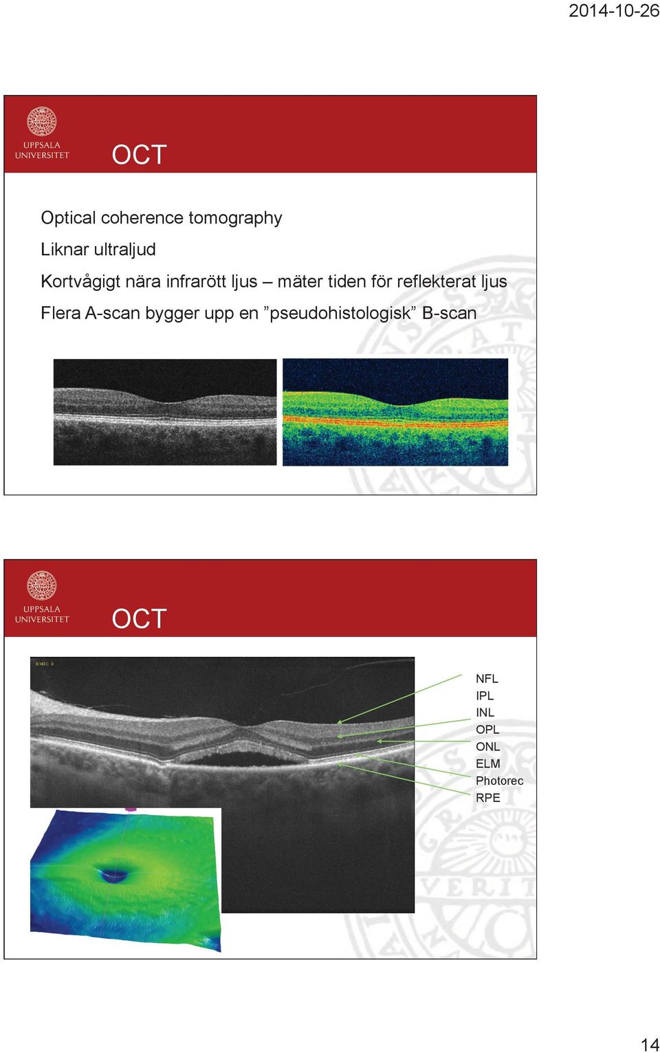 för reflekterat ljus Flera A-scan bygger upp en