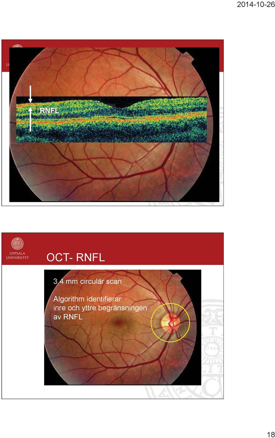 4 mm circulär scan Algorithm