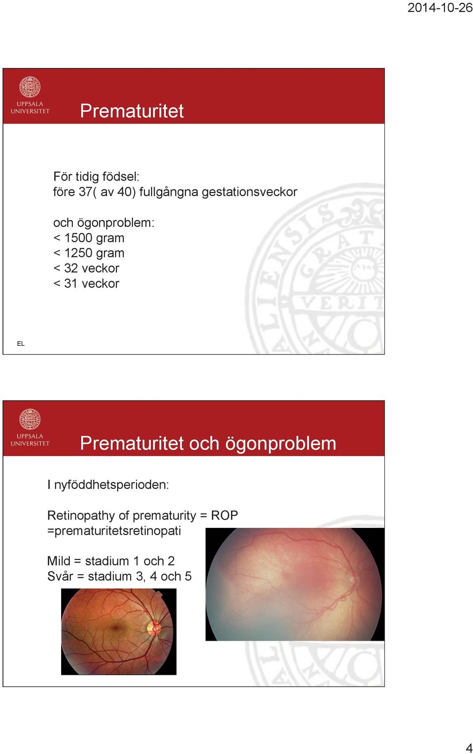 Prematuritet och ögonproblem I nyföddhetsperioden: Retinopathy of