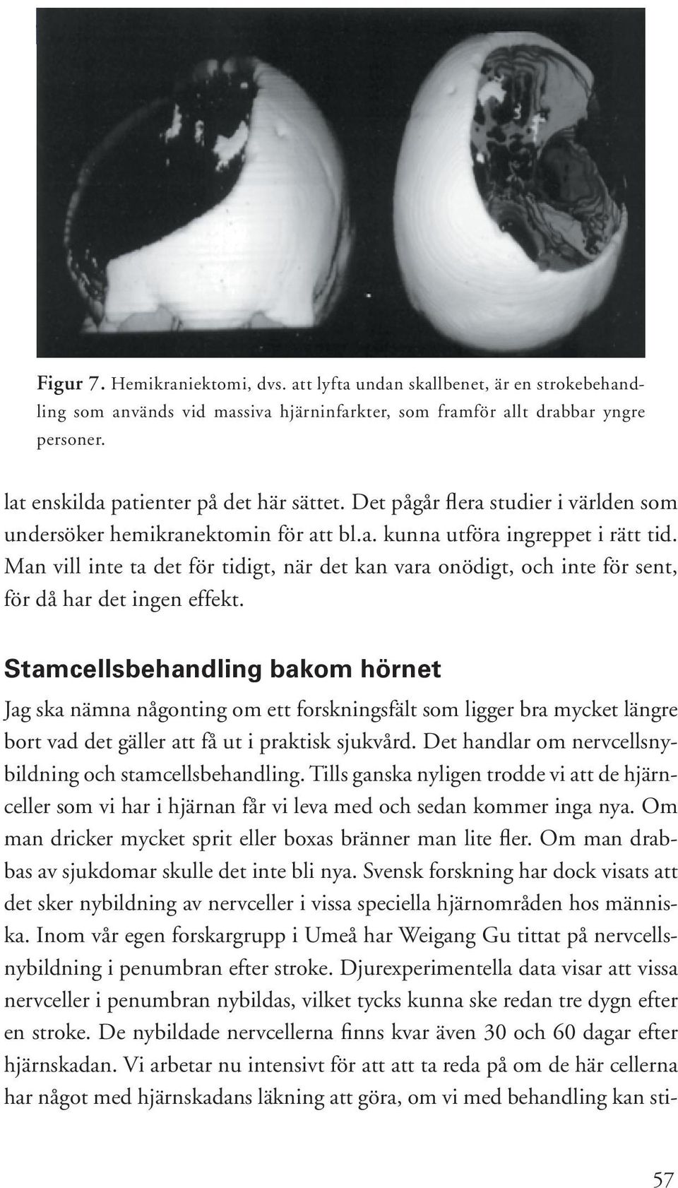 Man vill inte ta det för tidigt, när det kan vara onödigt, och inte för sent, för då har det ingen effekt.