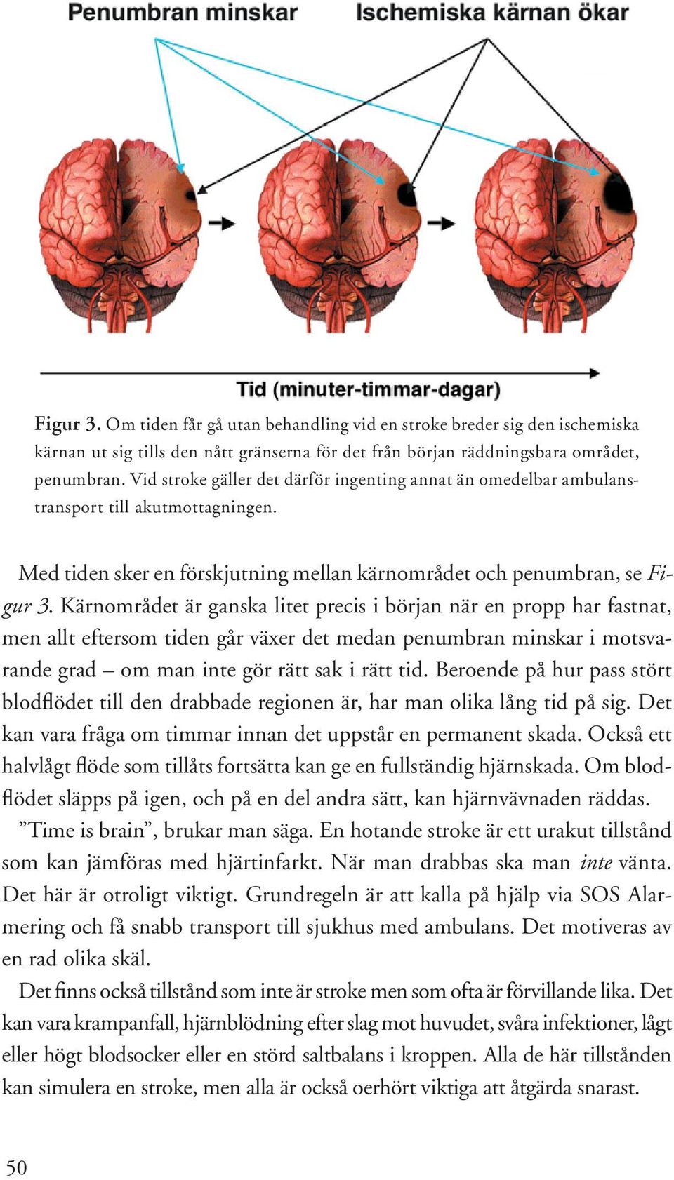 Kärnområdet är ganska litet precis i början när en propp har fastnat, men allt eftersom tiden går växer det medan penumbran minskar i motsvarande grad om man inte gör rätt sak i rätt tid.