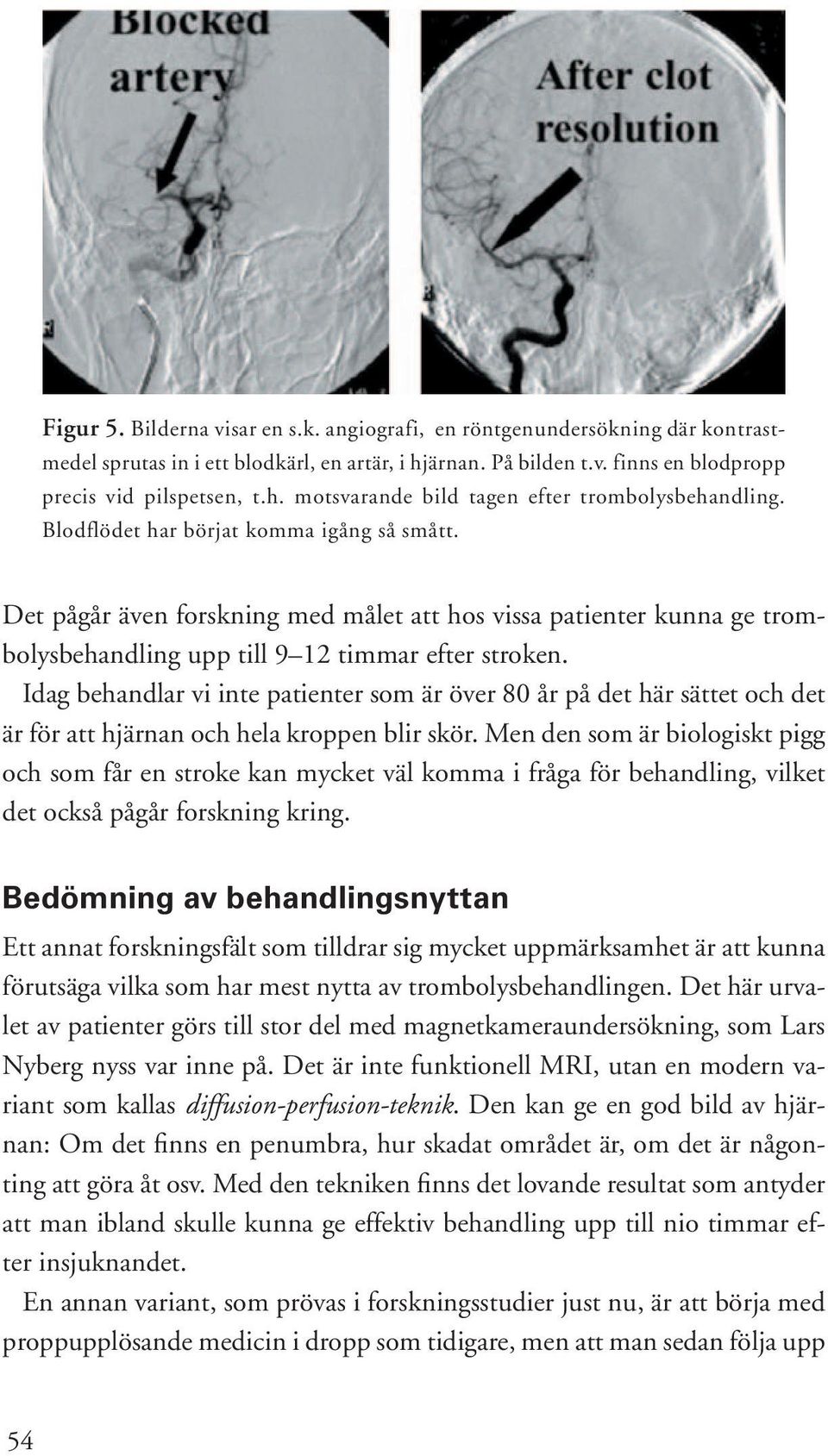 Idag behandlar vi inte patienter som är över 80 år på det här sättet och det är för att hjärnan och hela kroppen blir skör.