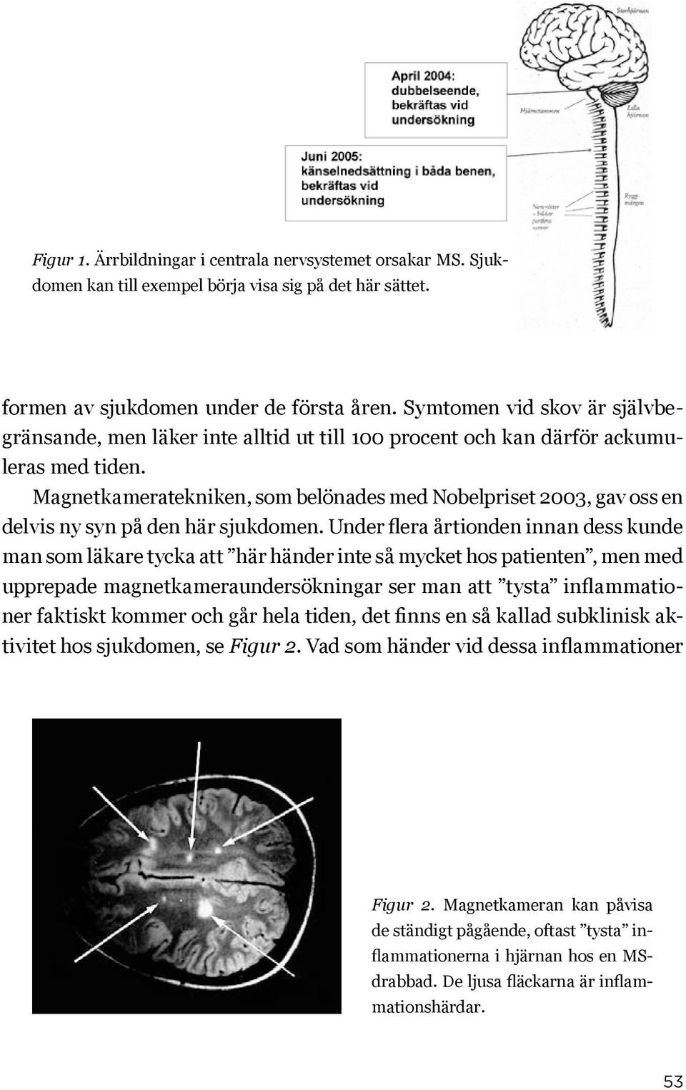 Magnetkameratekniken, som belönades med Nobelpriset 2003, gav oss en delvis ny syn på den här sjukdomen.