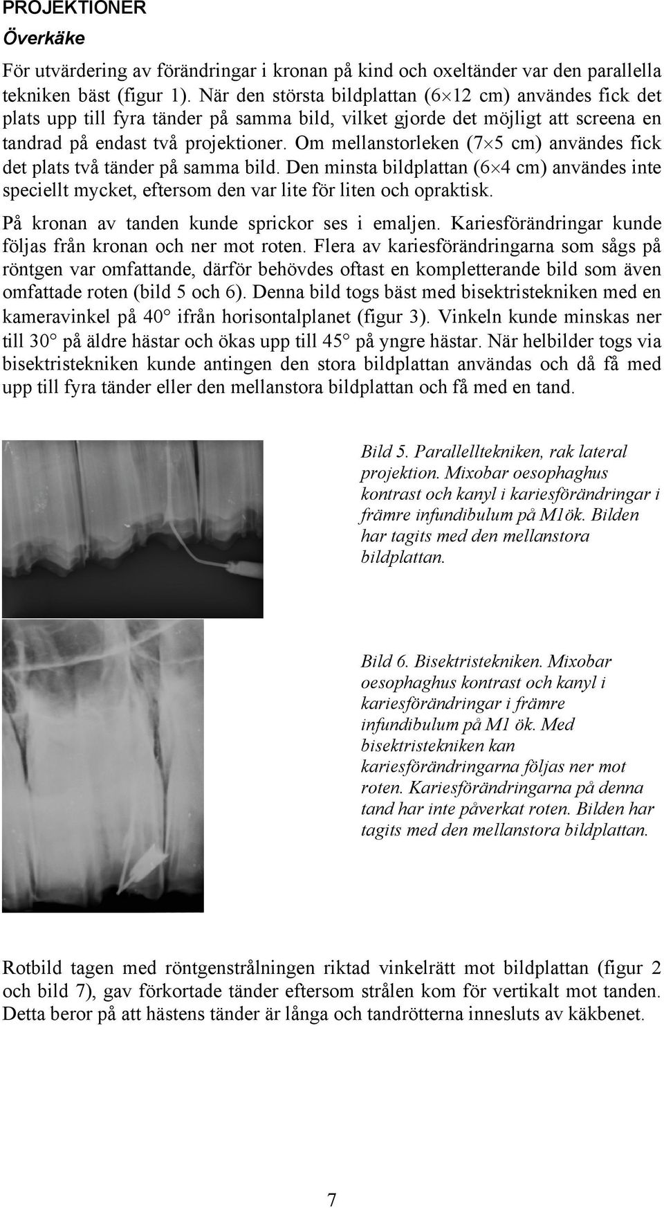 Om mellanstorleken (7 5 cm) användes fick det plats två tänder på samma bild. Den minsta bildplattan (6 4 cm) användes inte speciellt mycket, eftersom den var lite för liten och opraktisk.