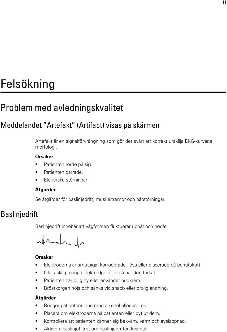 Baslinjedrift innebär att vågformen fluktuerar uppåt och nedåt. Orsaker Elektroderna är smutsiga, korroderade, lösa eller placerade på benutskott.