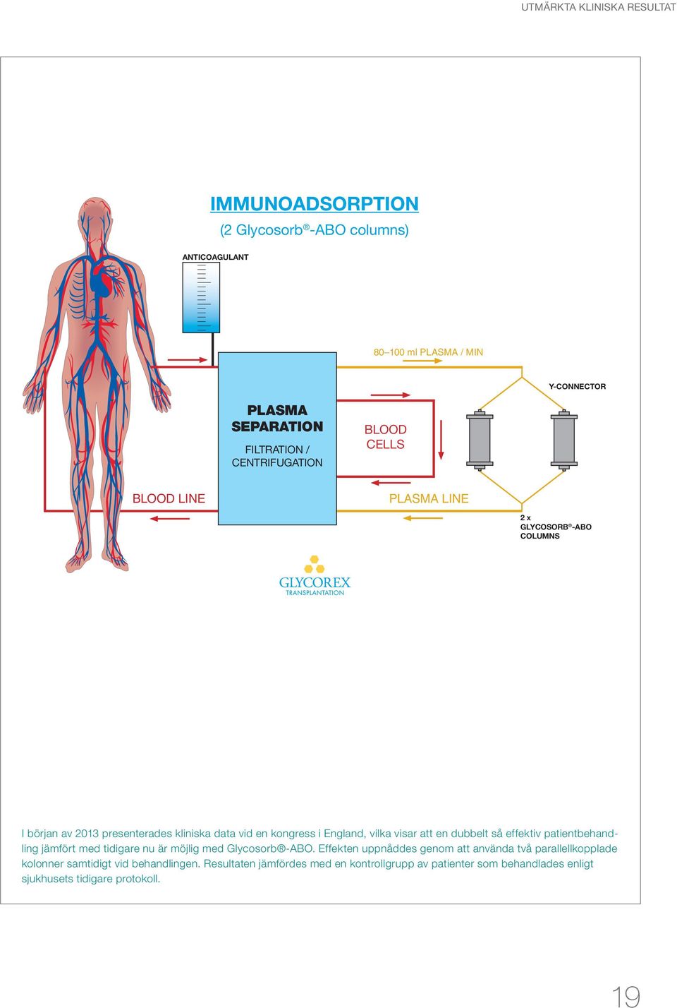 visar att en dubbelt så effektiv patientbehandling jämfört med tidigare nu är möjlig med Glycosorb -ABO.