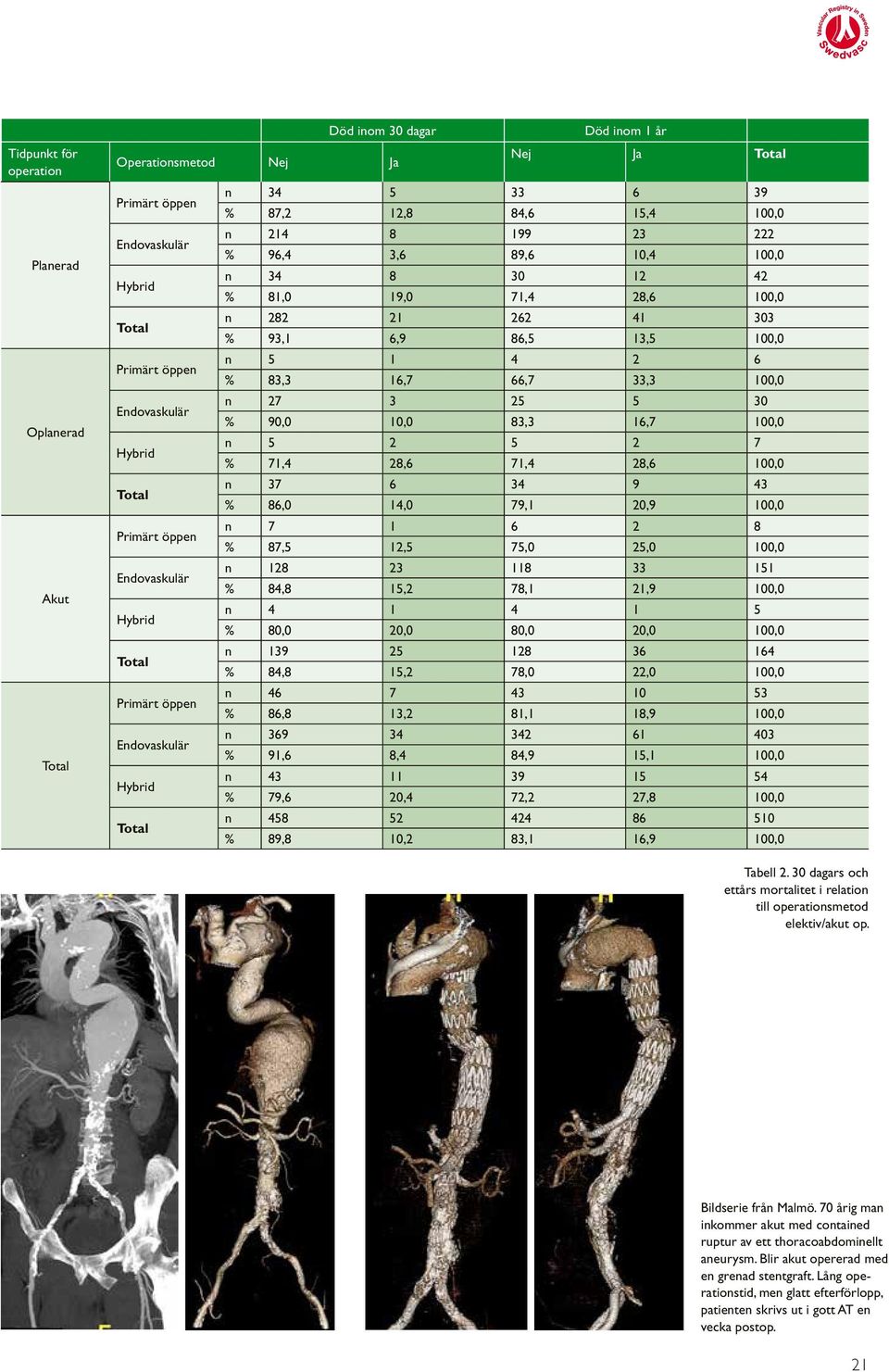 Endovaskulär n 27 3 25 5 30 % 90,0 10,0 83,3 16,7 100,0 Hybrid n 5 2 5 2 7 % 71,4 28,6 71,4 28,6 100,0 Total n 37 6 34 9 43 % 86,0 14,0 79,1 20,9 100,0 Primärt öppen n 7 1 6 2 8 % 87,5 12,5 75,0 25,0