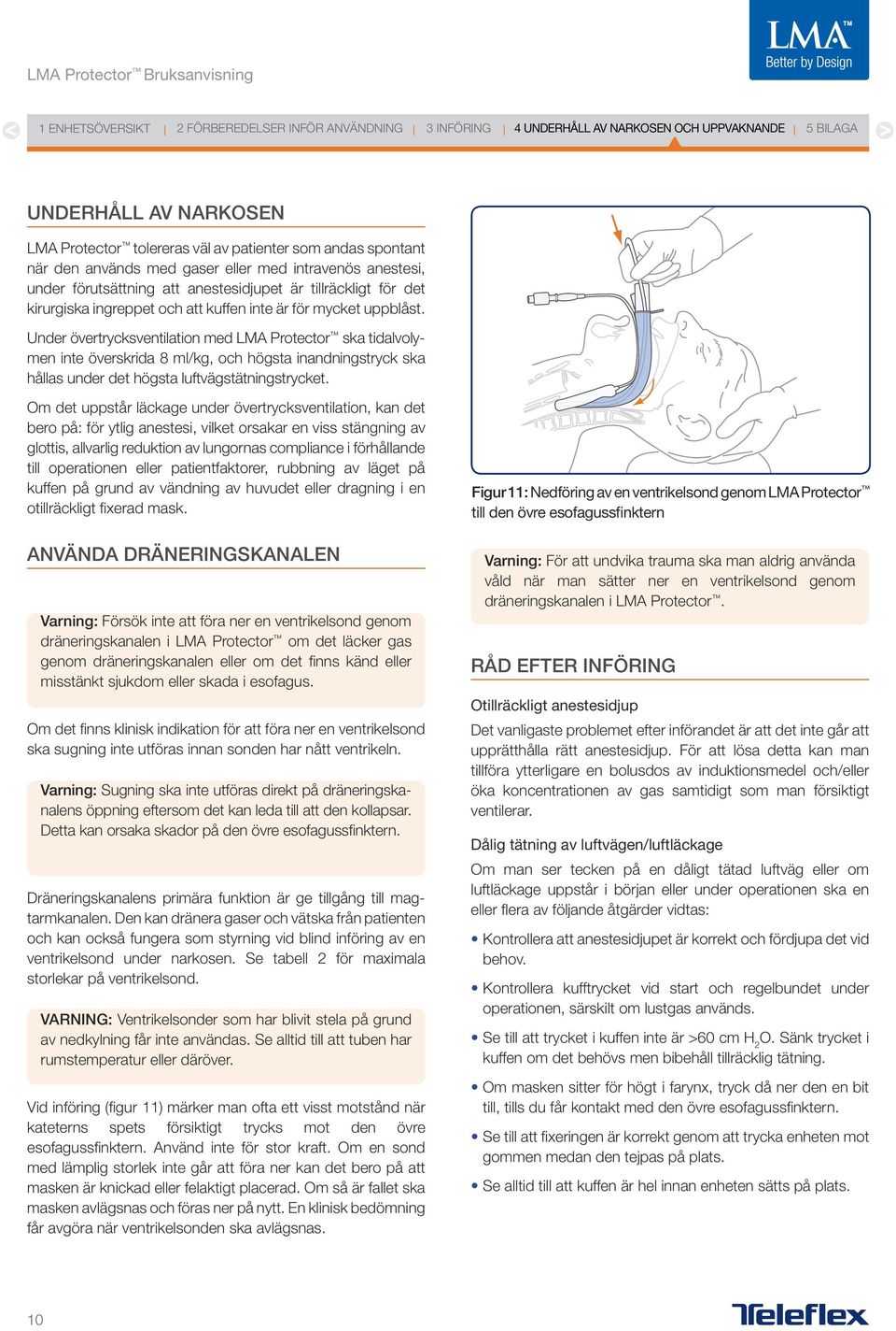 Under övertrycksventilation med LMA Protector ska tidalvolymen inte överskrida 8 ml/kg, och högsta inandningstryck ska hållas under det högsta luftvägstätningstrycket.