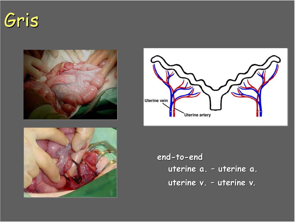 to-end uterine a.