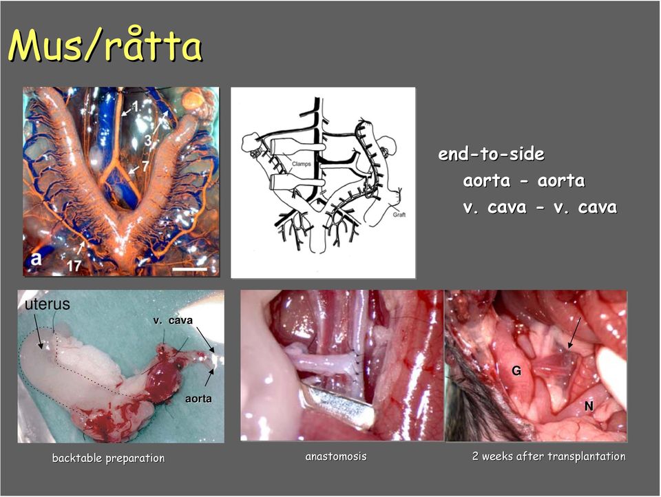 cava G aorta N backtable preparation