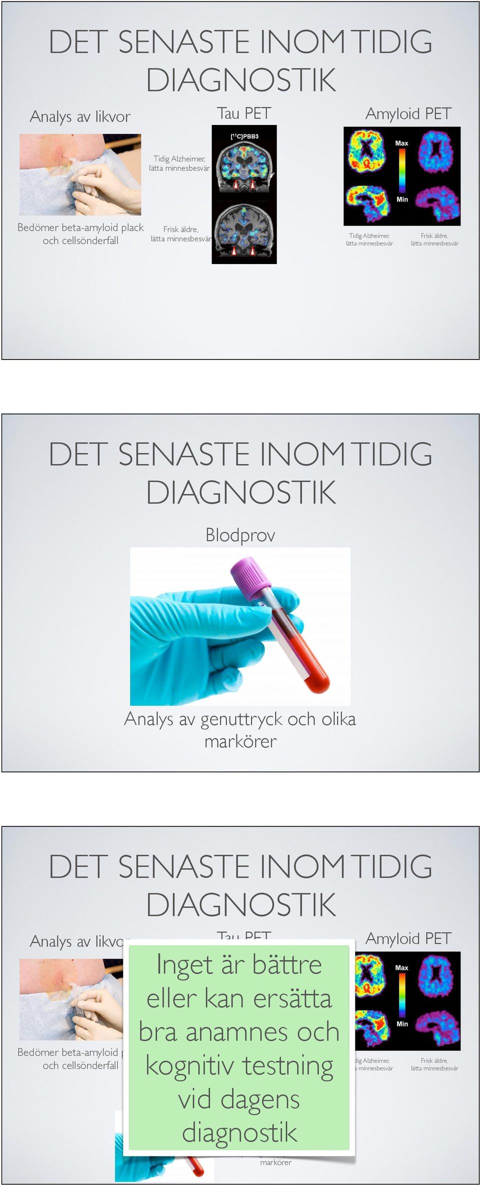 TIDIG DIAGNOSTIK Analys av likvor Tau PET Inget är bättre eller kan ersätta bra anamnes och kognitiv testning Blodprov vid dagens diagnostik Amyloid PET Tidig Alzheimer, lätta