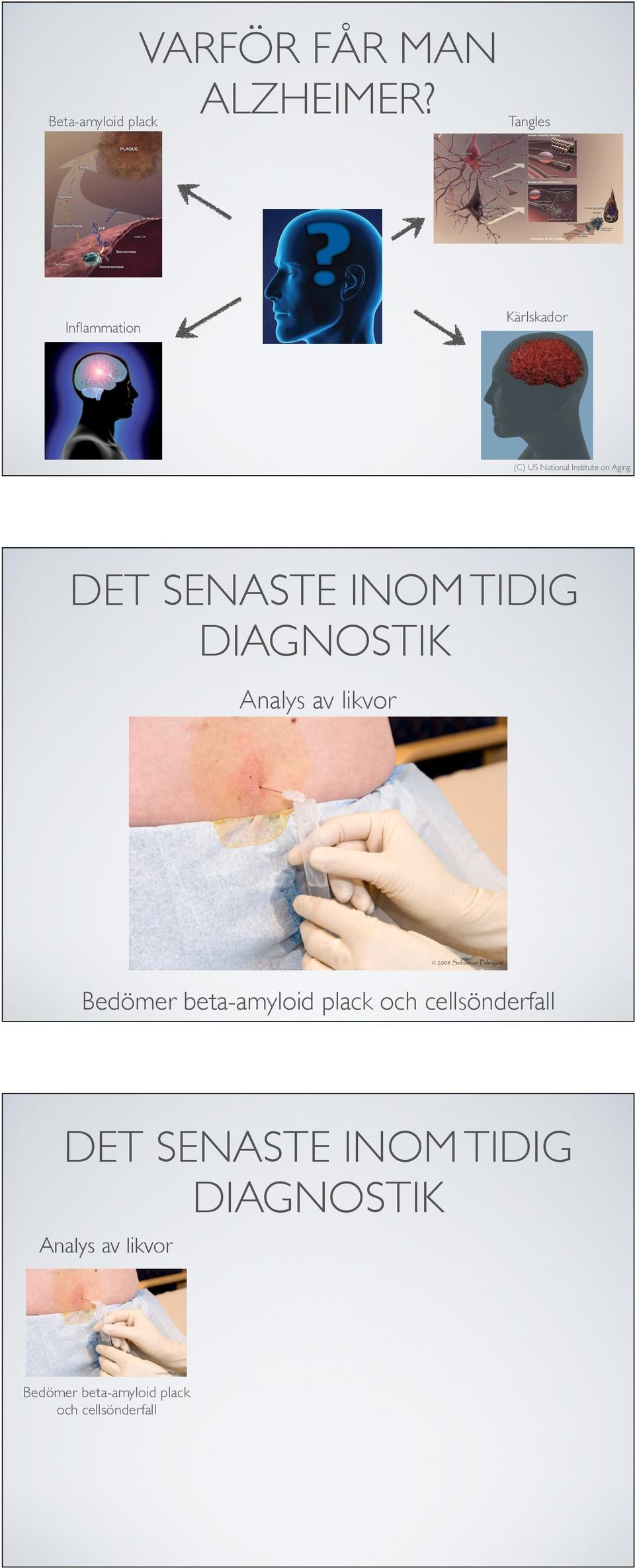 on Aging DET SENASTE INOM TIDIG DIAGNOSTIK Analys av likvor Bedömer