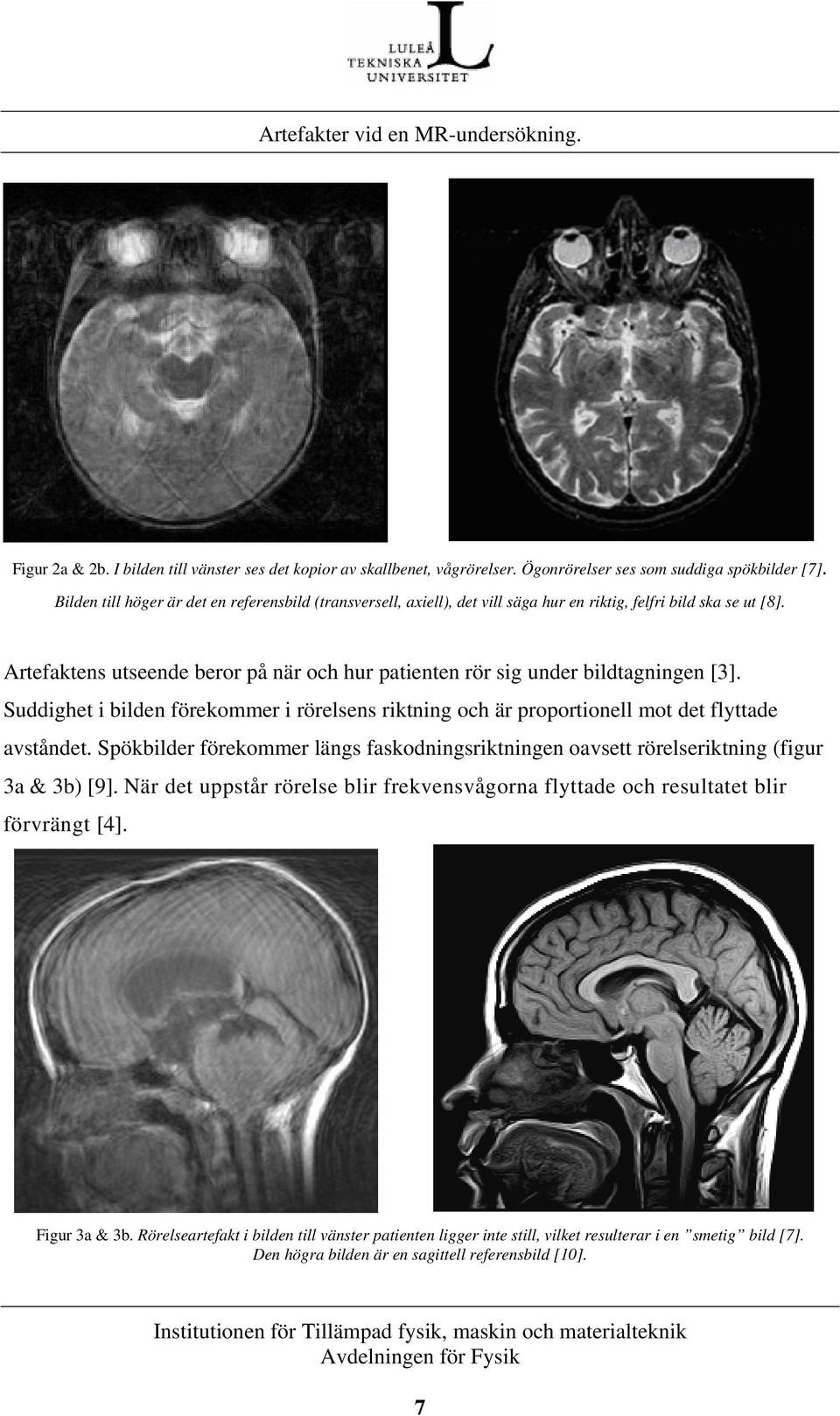 Artefaktens utseende beror på när och hur patienten rör sig under bildtagningen [3]. Suddighet i bilden förekommer i rörelsens riktning och är proportionell mot det flyttade avståndet.