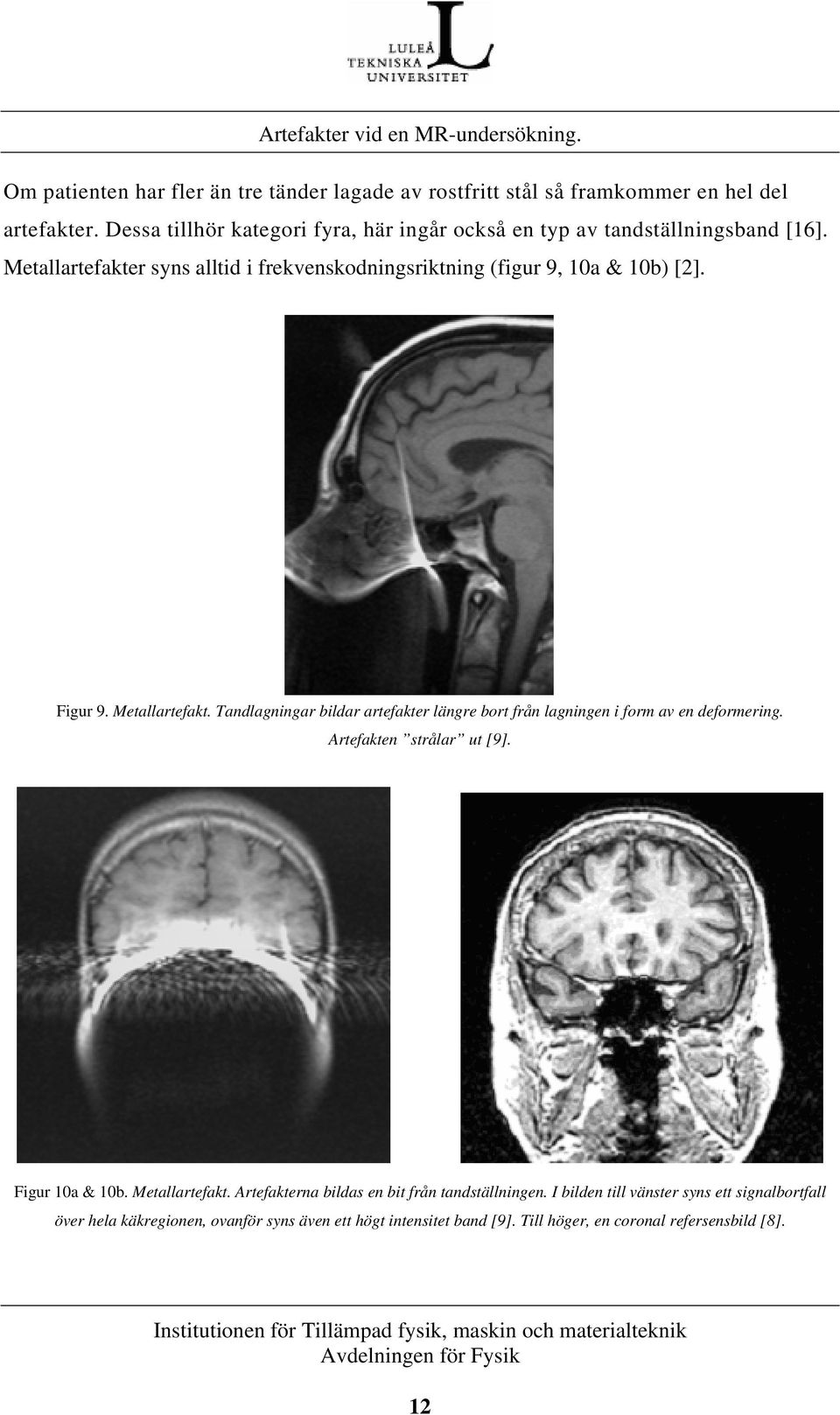 Metallartefakter syns alltid i frekvenskodningsriktning (figur 9, 10a & 10b) [2]. Figur 9. Metallartefakt.