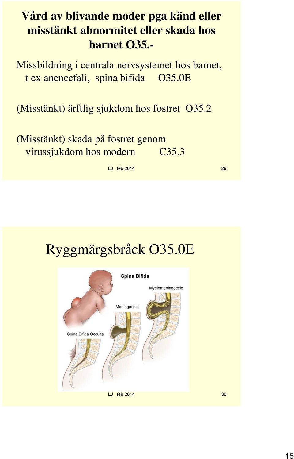 O35.0E (Misstänkt) ärftlig sjukdom hos fostret O35.