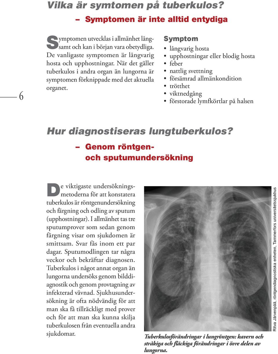 Symptom långvarig hosta upphostningar eller blodig hosta feber nattlig svettning försämrad allmänkondition trötthet viktnedgång förstorade lymfkörtlar på halsen Hur diagnostiseras lungtuberkulos?