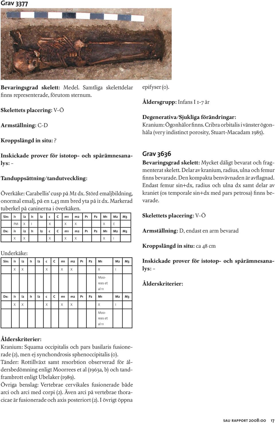 Åldersgrupp: Infans I 1-7 år Kranium: Ögonhålor finns. Cribra orbitalis i vänster ögonhåla (very indistinct porosity, Stuart-Macadam 1985).