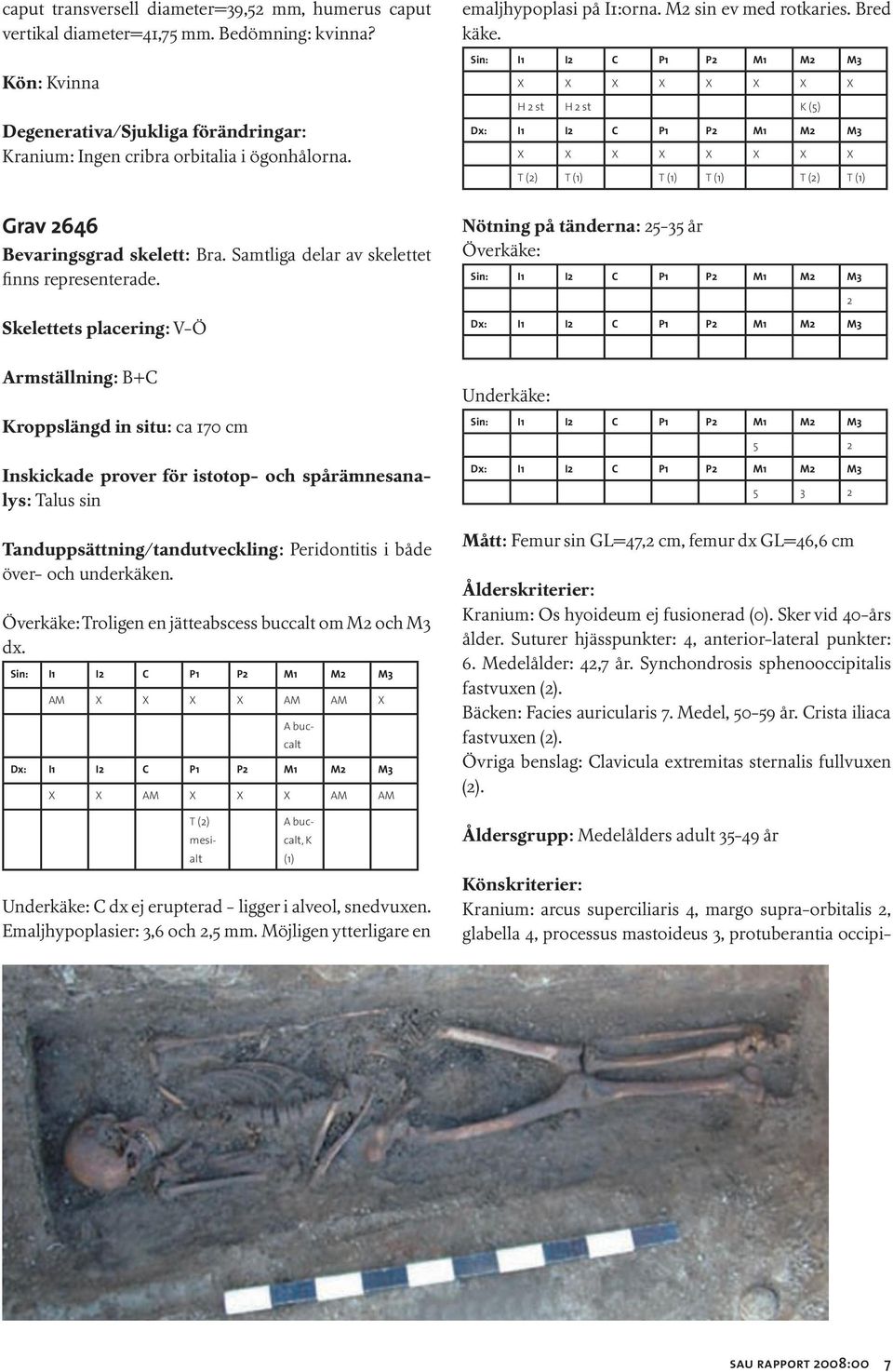 Nötning på tänderna: 25-35 år Överkäke: 2 Armställning: B+C Kroppslängd in situ: ca 170 cm Talus sin Peridontitis i både över- och underkäken. Överkäke: Troligen en jätteabscess om M2 och M3 dx.