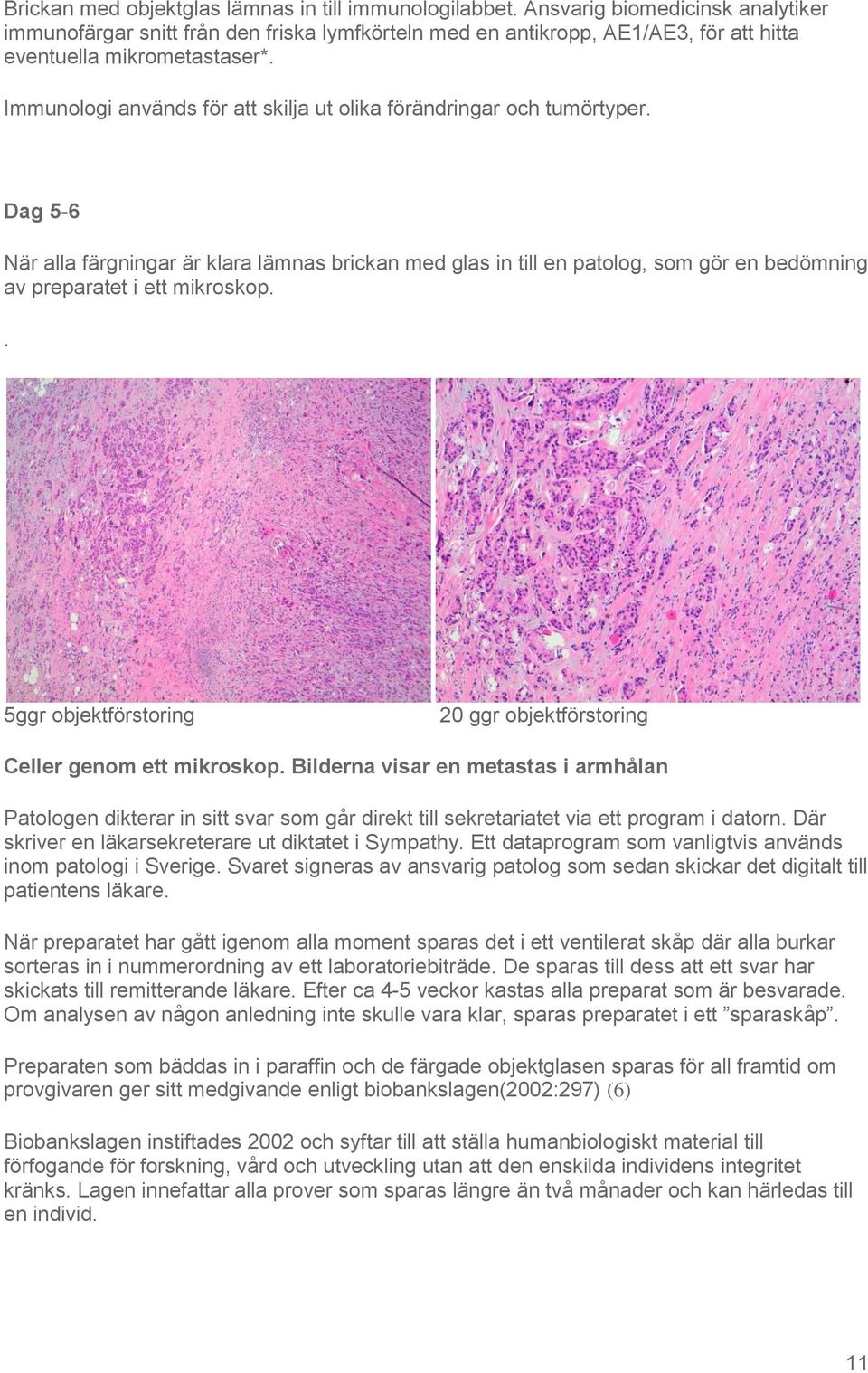 Immunologi används för att skilja ut olika förändringar och tumörtyper.