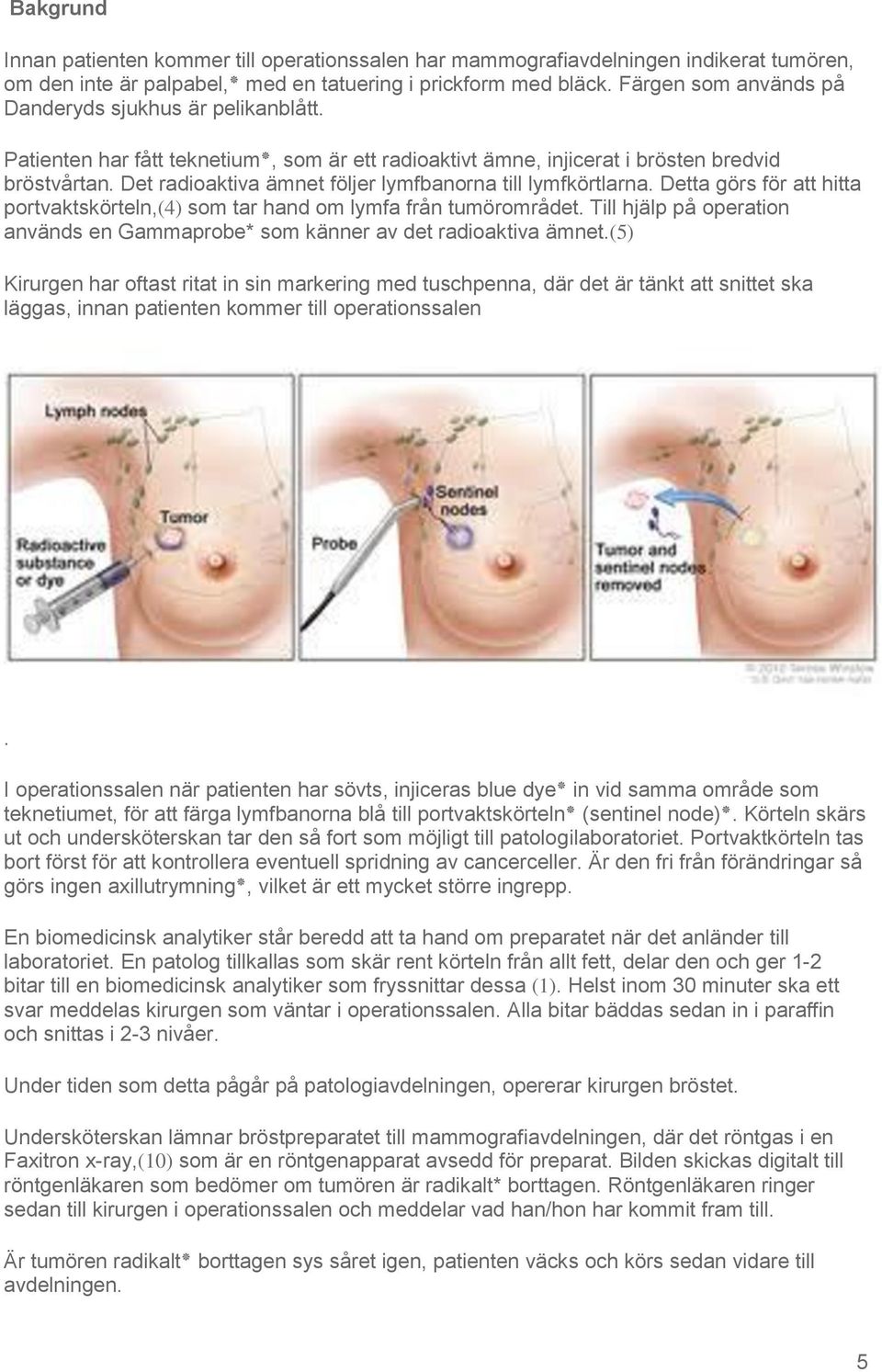 Det radioaktiva ämnet följer lymfbanorna till lymfkörtlarna. Detta görs för att hitta portvaktskörteln,(4) som tar hand om lymfa från tumörområdet.