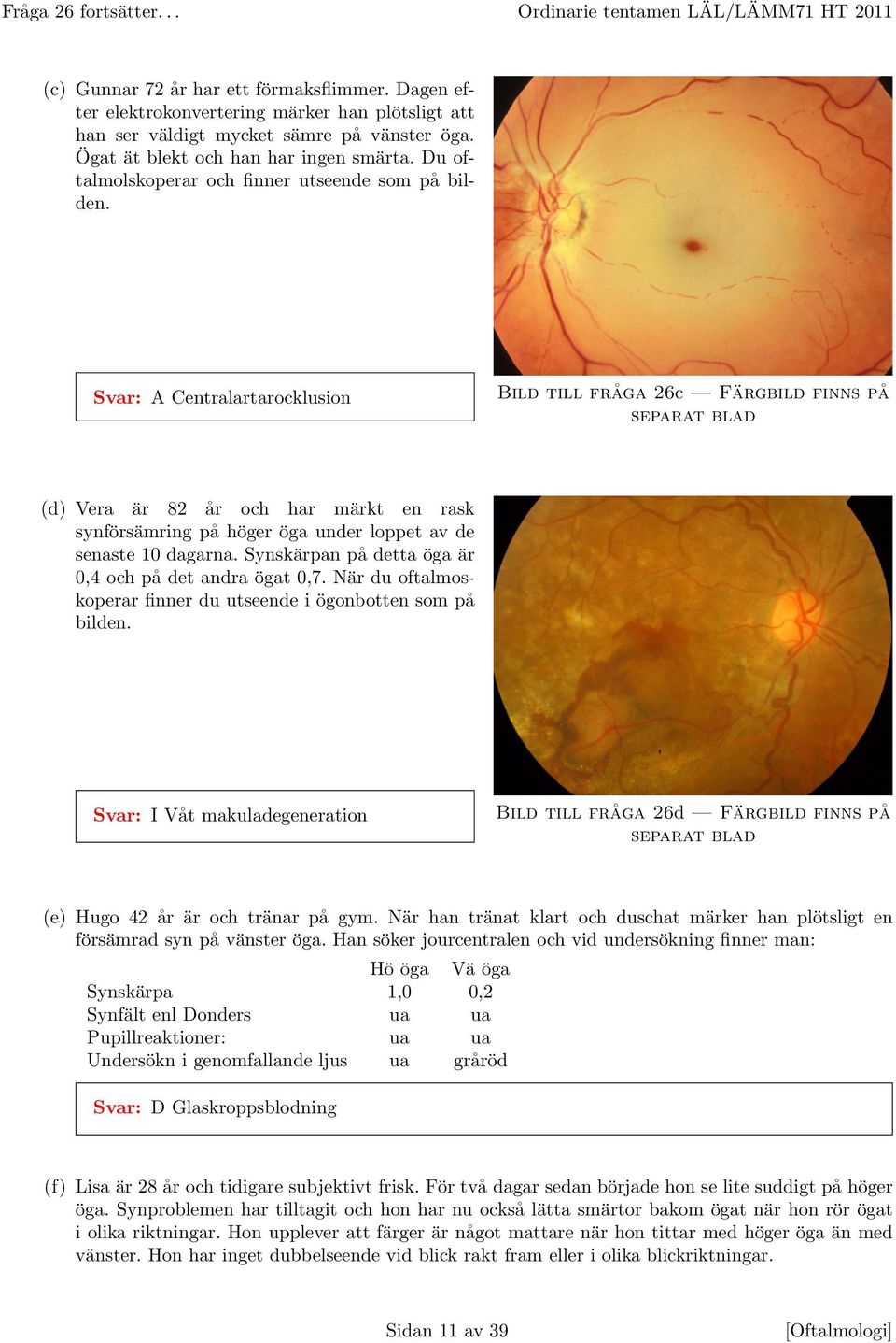 Svar: A Centralartarocklusion Bild till fråga 26c Färgbild finns på separat blad (d) Vera är 82 år och har märkt en rask synförsämring på höger öga under loppet av de senaste 10 dagarna.