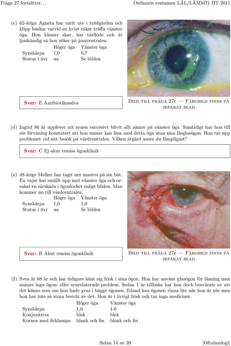 Höger öga Vänster öga Synskärpa 1,0 0,7 Status i övr ua Se bilden Svar: E Antibiotikasalva Bild till fråga 27c Färgbild finns på separat blad (d) Ingrid 86 år upplever att synen succesivt blivit allt