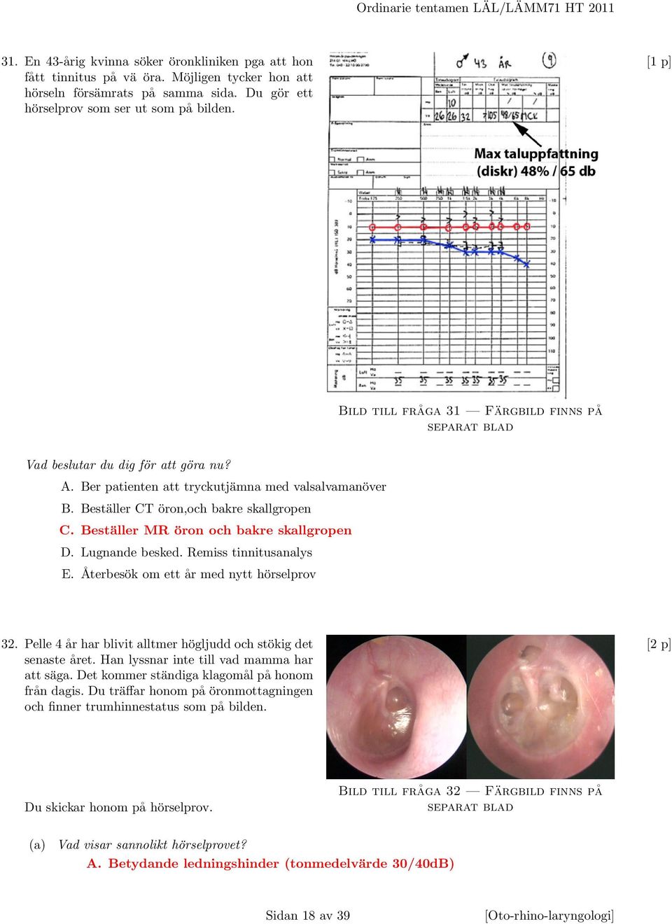 Beställer CT öron,och bakre skallgropen C. Beställer MR öron och bakre skallgropen D. Lugnande besked. Remiss tinnitusanalys E. Återbesök om ett år med nytt hörselprov 32.