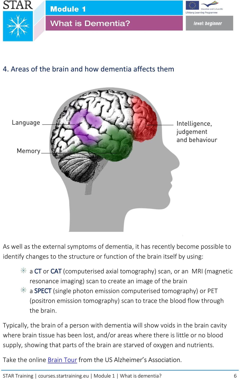 (positron emission tomography) scan to trace the blood flow through the brain.