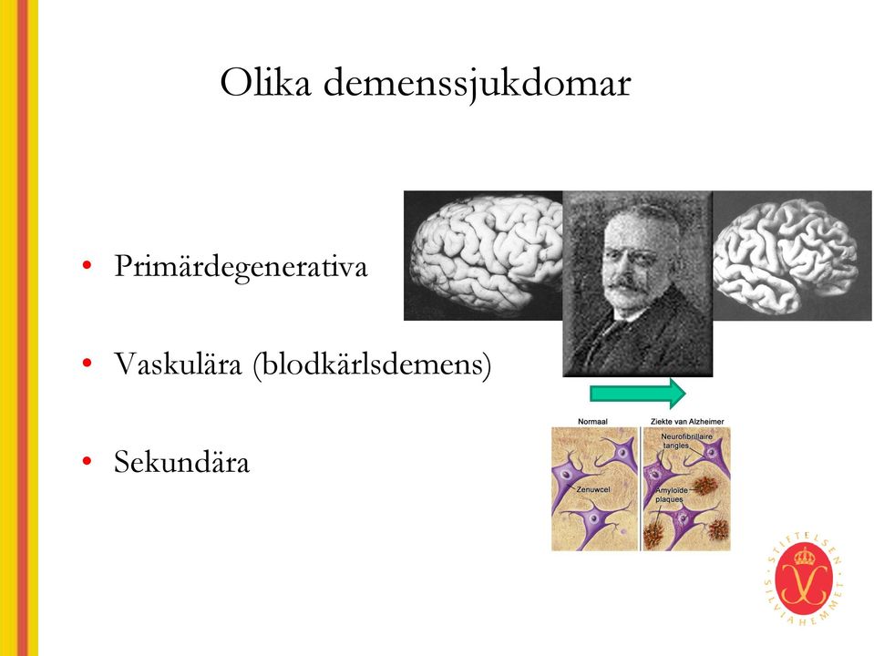 Primärdegenerativa