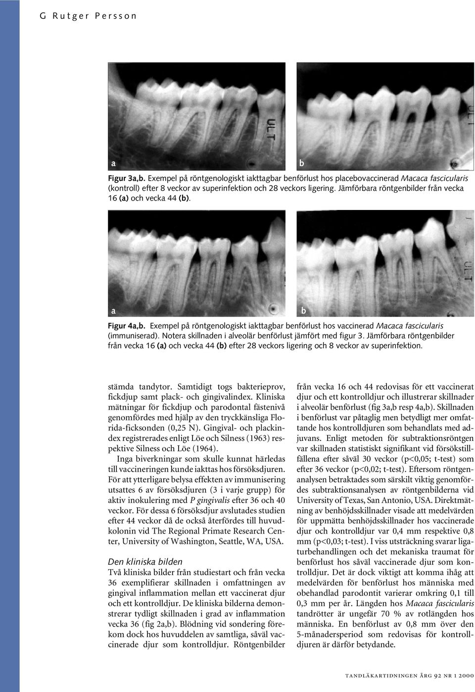 Notera skillnaden i alveolär benförlust jämfört med figur 3. Jämförbara röntgenbilder från vecka 16 (a) och vecka 44 (b) efter 28 veckors ligering och 8 veckor av superinfektion. b stämda tandytor.