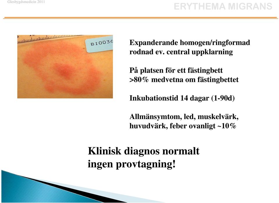 fästingbettet Inkubationstid 14 dagar (1-90d) Allmänsymtom, led,