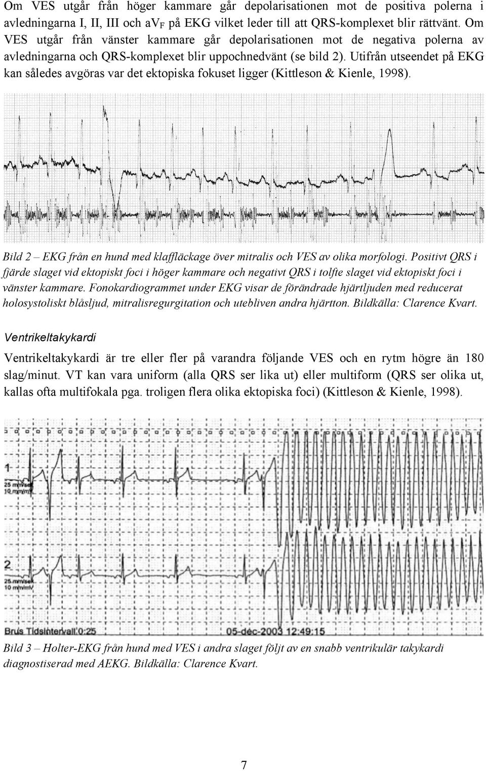 Utifrån utseendet på EKG kan således avgöras var det ektopiska fokuset ligger (Kittleson & Kienle, 1998). Bild 2 EKG från en hund med klaffläckage över mitralis och VES av olika morfologi.