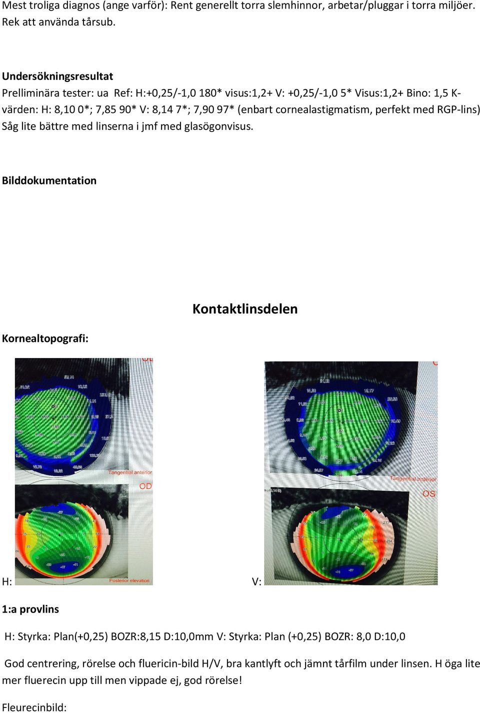 cornealastigmatism, perfekt med RGPlins) Såg lite bättre med linserna i jmf med glasögonvisus.