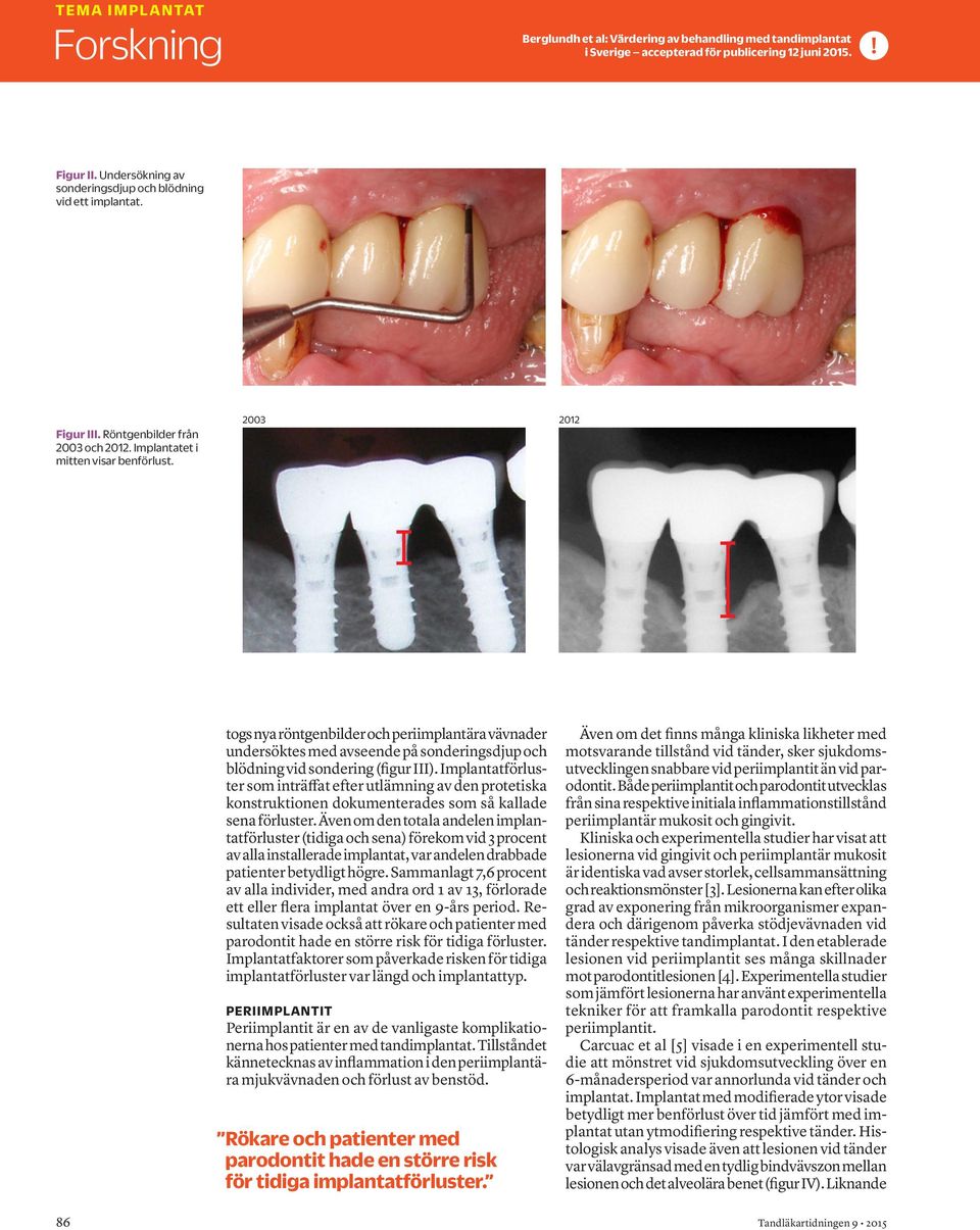 2003 2012 togs nya röntgenbilder och periimplantära vävnader undersöktes med avseende på sonderingsdjup och blödning vid sondering (figur III).