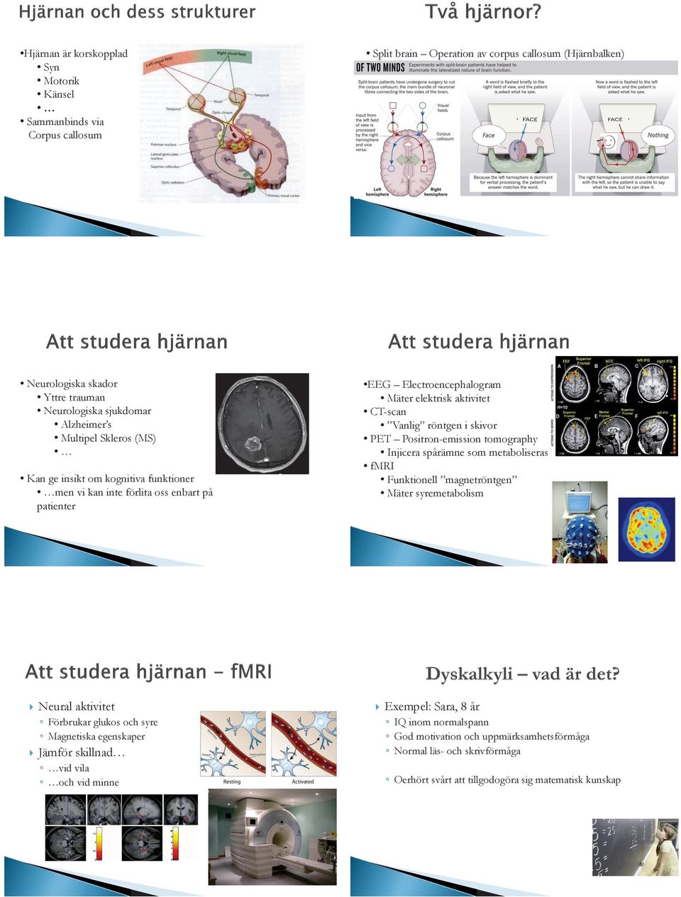 skillnad vid vila och vid minne EEG Electroencephalogram Mäter elektrisk aktivitet CT-scan Vanlig röntgen i skivor PET Positron-emission tomography Injicera spårämne som metaboliseras fmri