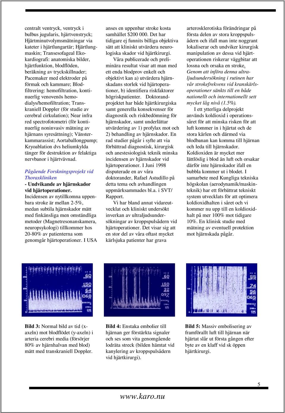 Transkraniell Doppler (för studie av cerebral cirkulation); Near infra red spectrofotometri (för kontinuerlig noninvasiv mätning av hjärnans syresättning); Vänsterkammarassist; Aortaballongpump;