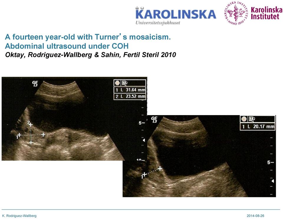 Abdominal ultrasound under COH