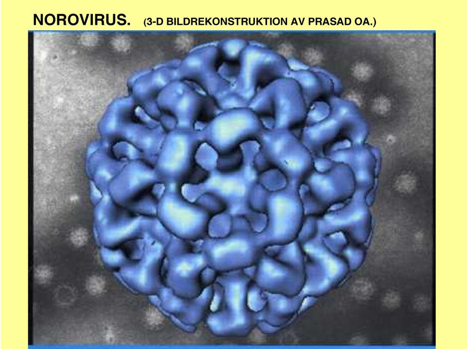 PRASAD) NOROVIRUS.