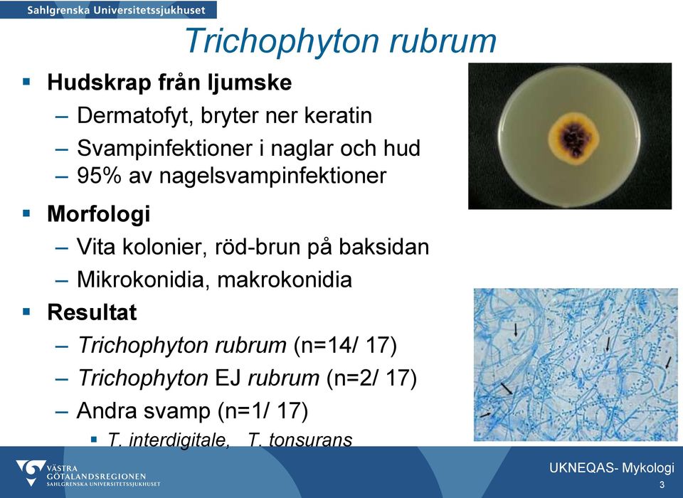 röd-brun på baksidan Mikrokonidia, makrokonidia Trichophyton rubrum (n=14/ 17)