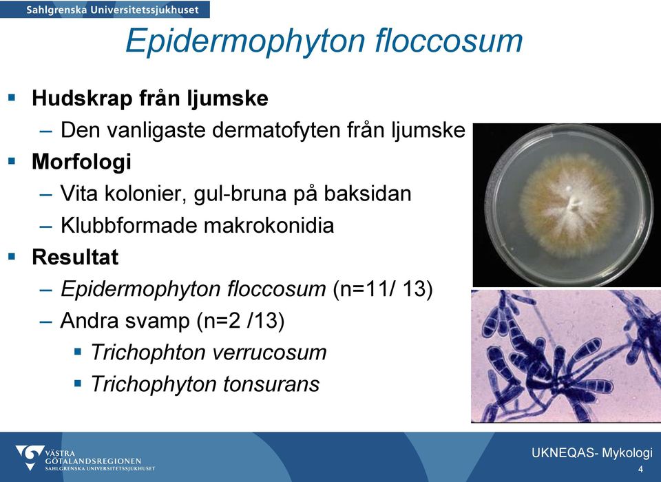 Klubbformade makrokonidia Epidermophyton floccosum (n=11/ 13)