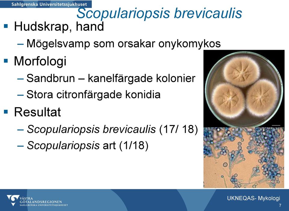 kanelfärgade kolonier Stora citronfärgade konidia