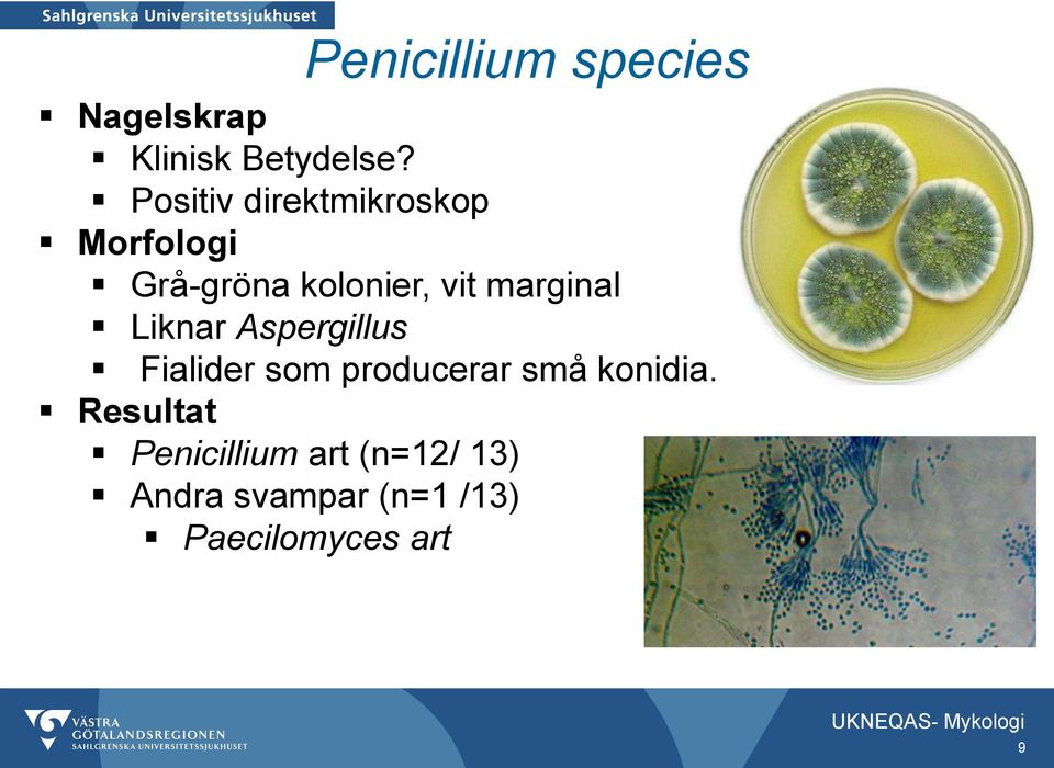 Liknar Aspergillus Fialider som producerar små konidia.