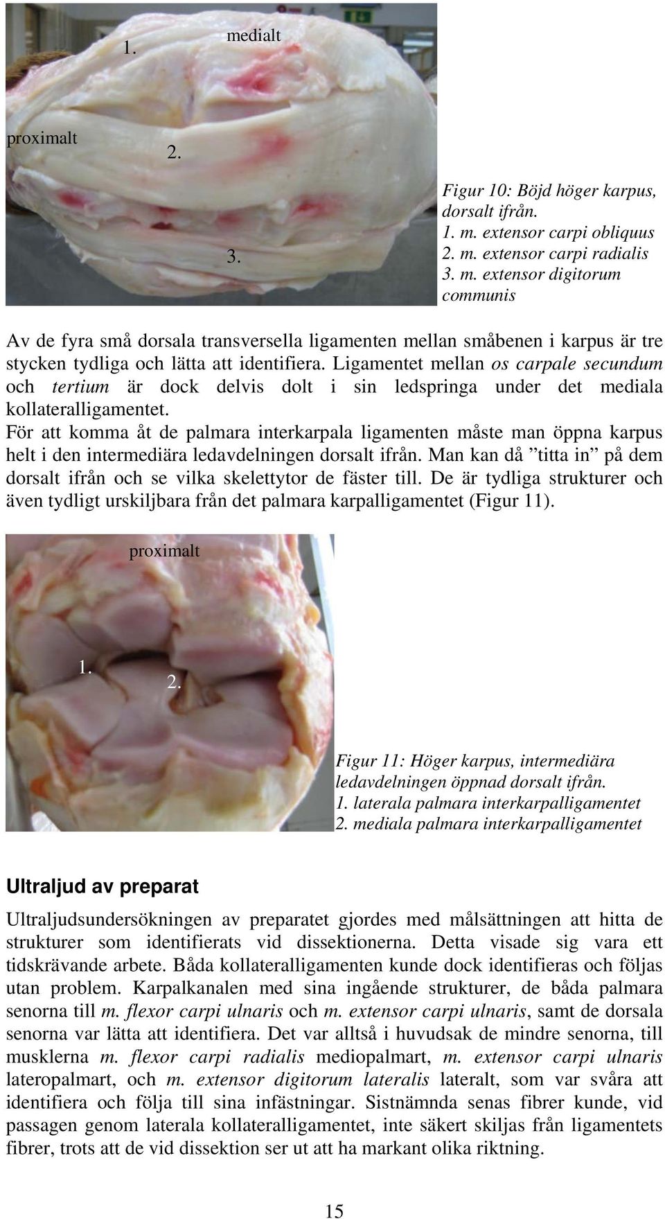 För att komma åt de palmara interkarpala ligamenten måste man öppna karpus helt i den intermediära ledavdelningen dorsalt ifrån.