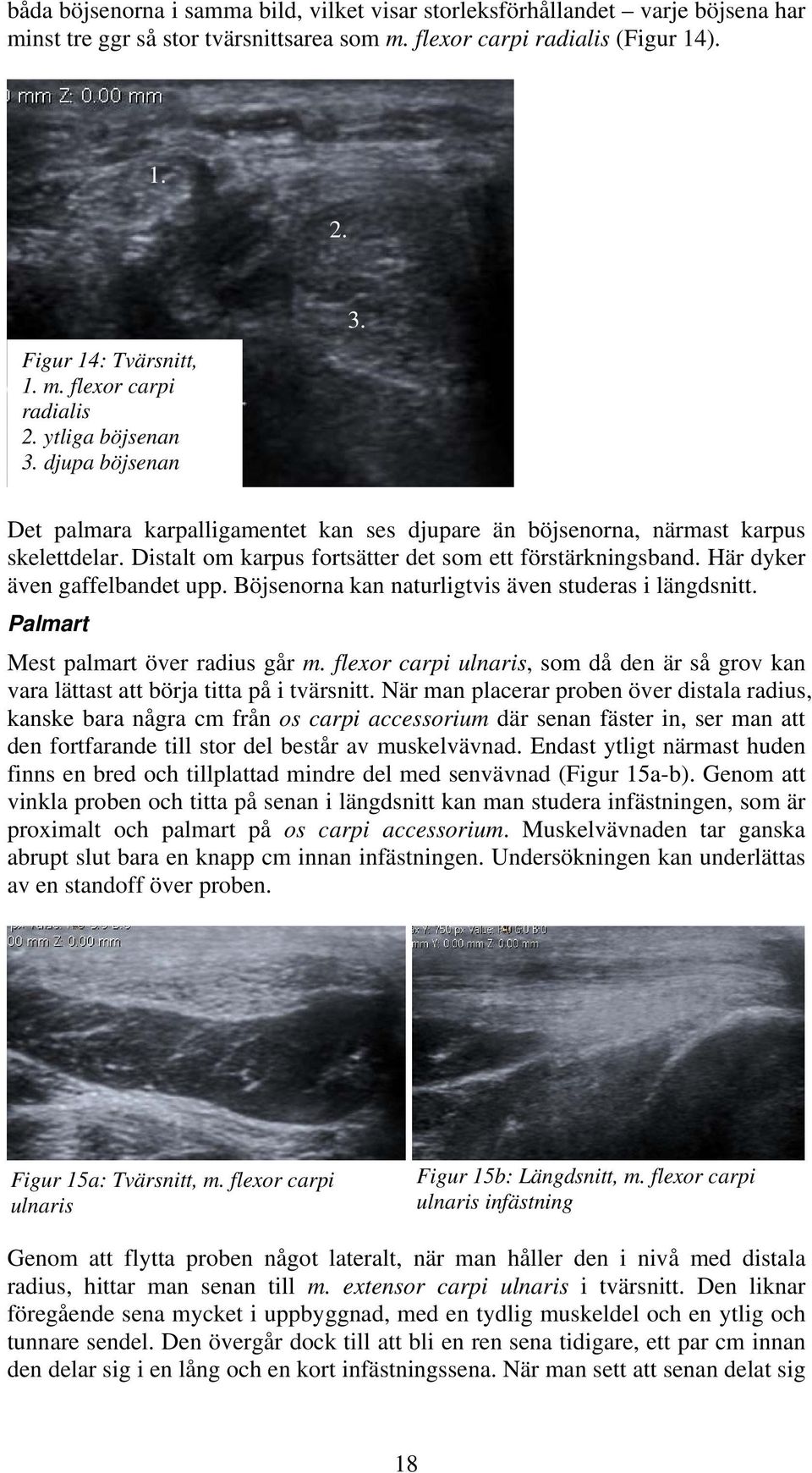 Här dyker även gaffelbandet upp. Böjsenorna kan naturligtvis även studeras i längdsnitt. Palmart Mest palmart över radius går m.