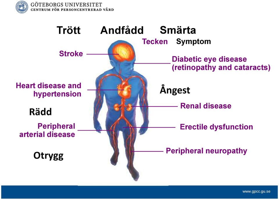 Diabetic eye disease (retinopathy and cataracts) Ångest