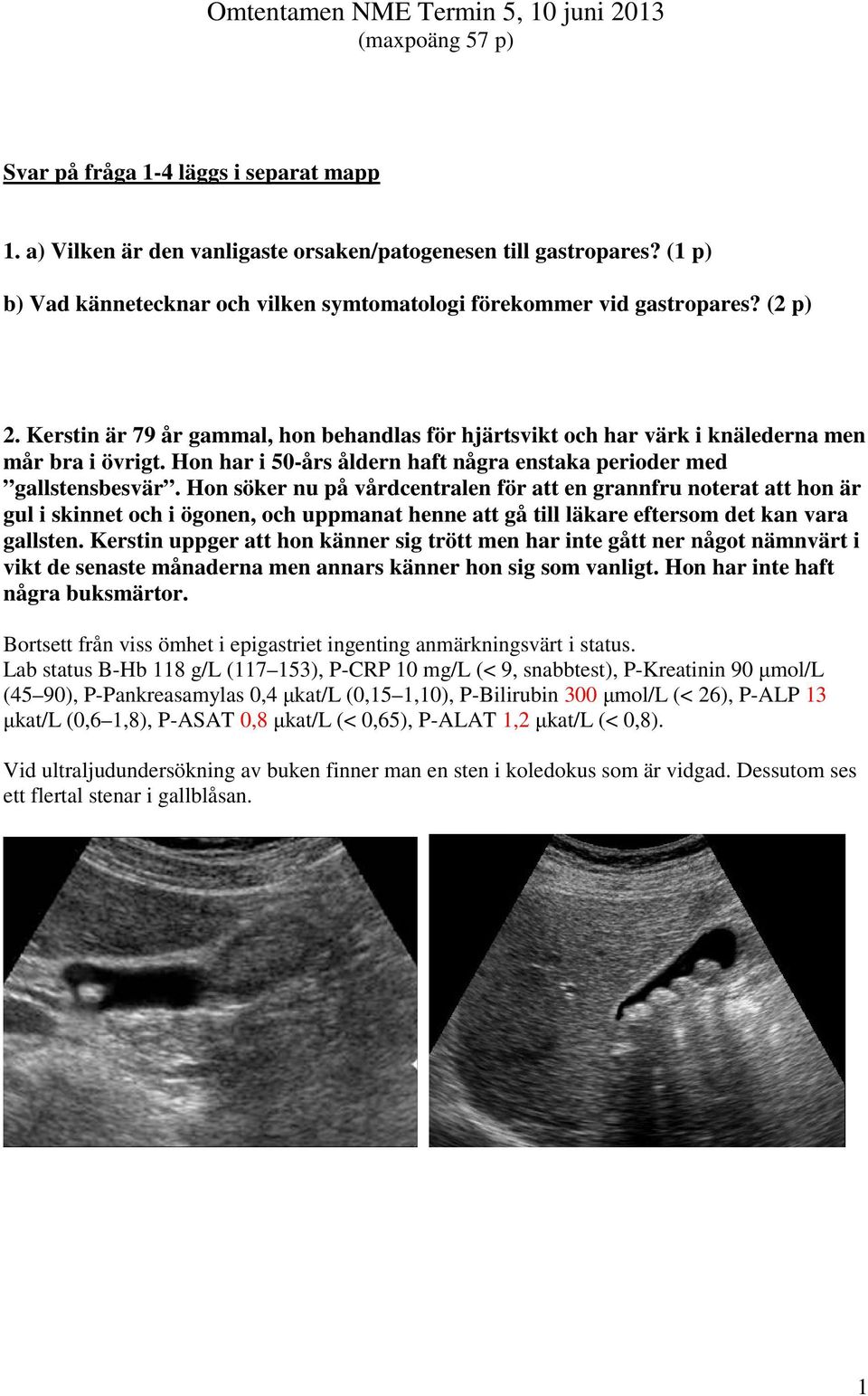 Hon har i 50-års åldern haft några enstaka perioder med gallstensbesvär.