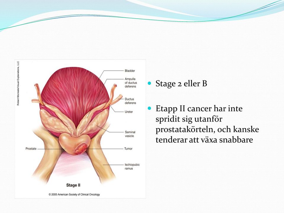 utanför prostatakörteln, och